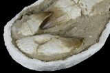Three, Large Rooted Mosasaur Teeth In Rock - Morocco #115781-5